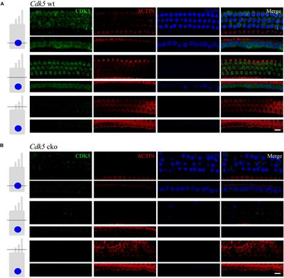 Inactivation of Cyclin-Dependent Kinase 5 in Hair Cells Causes Hearing Loss in Mice